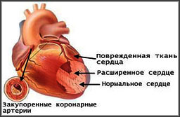сердце